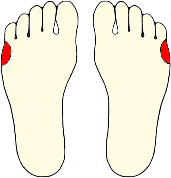 -