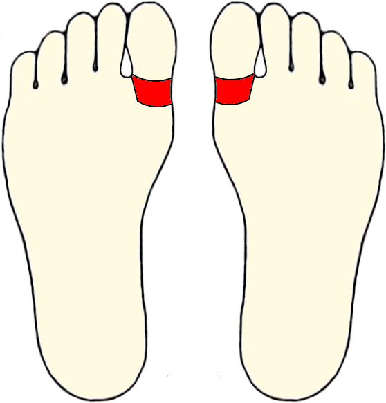 -