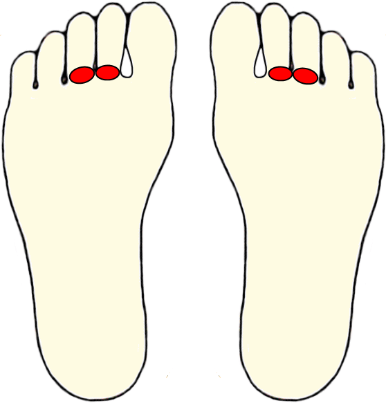 -