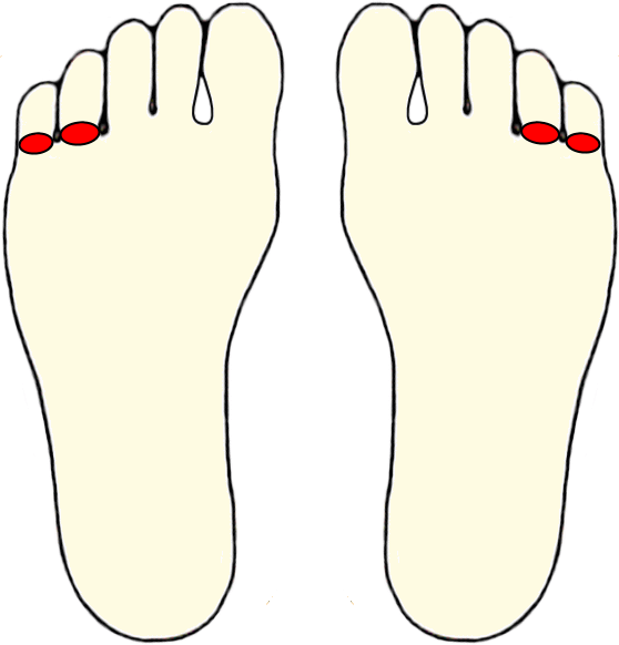 -